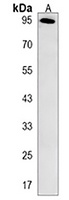 ARMC5 Rabbit Polyclonal Antibody