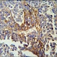 ARMC5 Rabbit Polyclonal Antibody