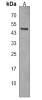 PYHIN1 Rabbit Polyclonal Antibody