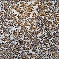 PYHIN1 Rabbit Polyclonal Antibody