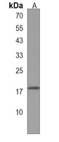 TRAPPC6A Antibody