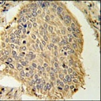 Anti-TRAPPC6A Antibody