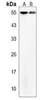 TMEM87B Rabbit Polyclonal Antibody