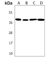 SRD5A3 Rabbit Polyclonal Antibody