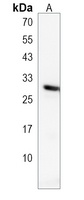 RSPO2 Antibody