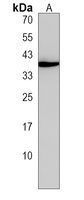 SLC25A28 Antibody