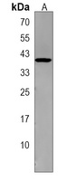 G6PC Rabbit Polyclonal Antibody