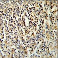 Anti-CCDC101 Antibody