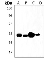 TUBB4B Rabbit Polyclonal Antibody