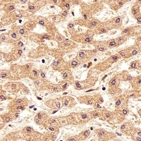 Anti-FOLH1B Antibody