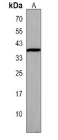PAAF1 Rabbit Polyclonal Antibody