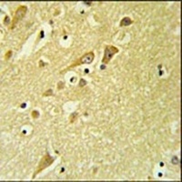 PAAF1 Rabbit Polyclonal Antibody