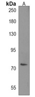 INO80D Rabbit Polyclonal Antibody