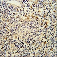 CORO6 Antibody