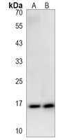 SNRPD1 Rabbit Polyclonal Antibody