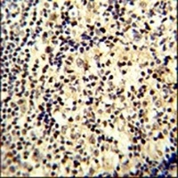 Anti-SNRPD1 Antibody