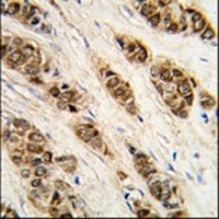 Anti-DCTPP1 Antibody