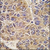 Anti-UGP2 Antibody