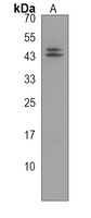 ART3 Rabbit Polyclonal Antibody
