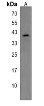 CH25H Rabbit Polyclonal Antibody