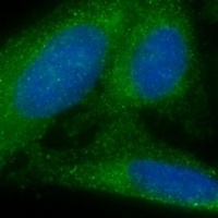 Anti-MVB12A Antibody