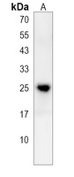 GSTA5 Rabbit Polyclonal Antibody