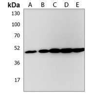 EEF1A1P5 Rabbit Polyclonal Antibody