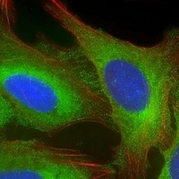 EEF1A1P5 Rabbit Polyclonal Antibody