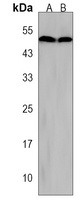 CTB Rabbit Polyclonal Antibody