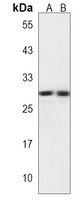 PPP1R3E Rabbit Polyclonal Antibody