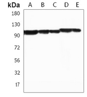 PCSK1 Rabbit Polyclonal Antibody