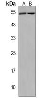 CHTF8 Antibody