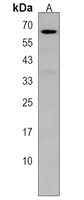 NUPL1 Rabbit Polyclonal Antibody