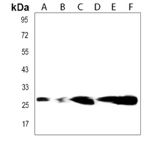 TIGIT Rabbit Polyclonal Antibody