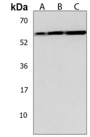 HEXDC Rabbit Polyclonal Antibody