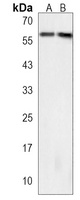 ALG6 Rabbit Polyclonal Antibody