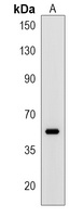 ERVK-21 Rabbit Polyclonal Antibody