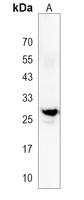 PRTN3 Rabbit Polyclonal Antibody