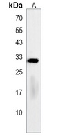 LHPP Rabbit Polyclonal Antibody