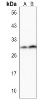 PPAPDC1B Antibody