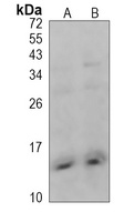 CXCL4 Rabbit Polyclonal Antibody