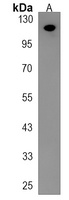 PTPN12 Rabbit Polyclonal Antibody