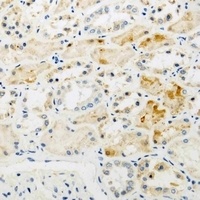 Anti-NAT8L Antibody