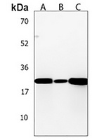 KCTD11 Antibody