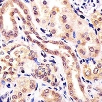 KCTD11 Antibody