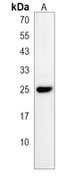TMED4 Rabbit Polyclonal Antibody