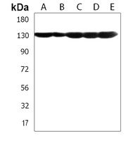 DDX42 Rabbit Polyclonal Antibody