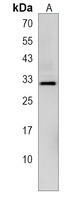 CLIC2 Antibody