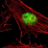 Anti-SNW1 Antibody