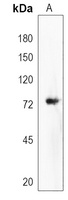 DVL1P1 Rabbit Polyclonal Antibody